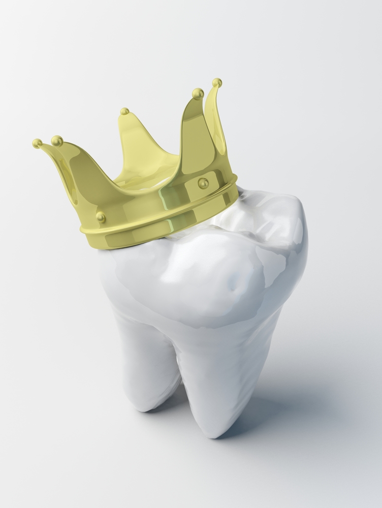 How Long Do CEREC Crowns Last? Scottsdale Smile