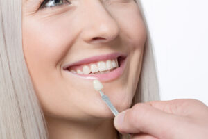 Full Mouth Rehabilitation